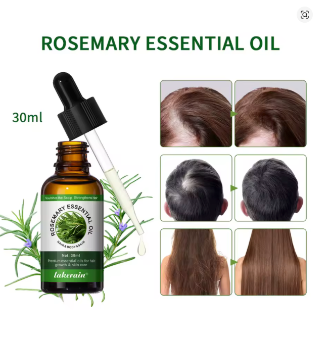 Rosemary™ Hair Growth Oil – Organic Scalp Strengthening & Nourishing Formula for Shiny, Healthy Hair