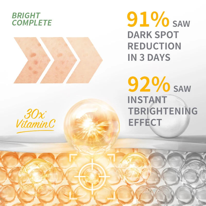Garnier Vitamin C + Niacinamide Brightening Serum 30ml – Fade Acne Marks, Even Skin Tone